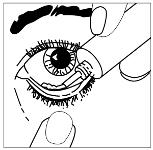 How to apply GoldenEye Eye Ointment